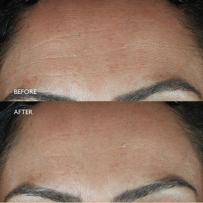 Age Benefit™ Regenerating Edit