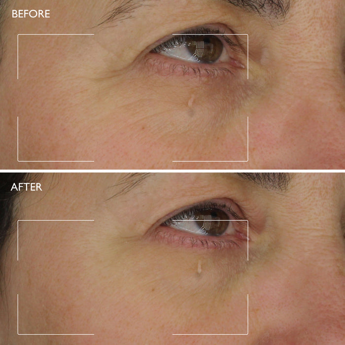 Age Benefit™ Regenerating Edit