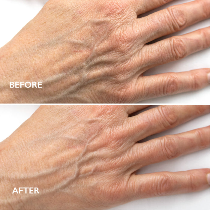 Renewal Ultime™ Skin Smoothing Edit