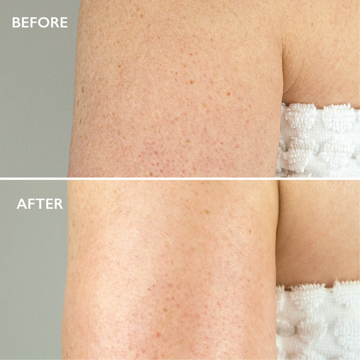 Renewal Ultime™ Skin Smoothing Edit